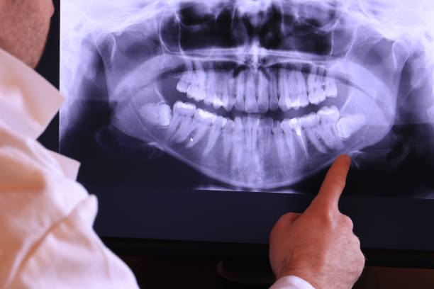 Best Emergency Treatment for Oral Infections in Red Oak, IA